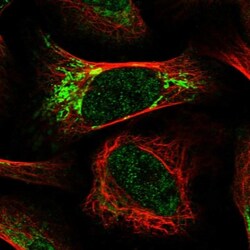 RTKN Antibody, Novus Biologicals 0.1mL; Unlabeled:Antibodies, Polyclonal